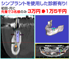 �V���v�����g���g�p�����f�f�L��I����A���ɐ撅��3���l�̂�3���~��1��5��~