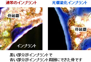 光機能化のメカニズム