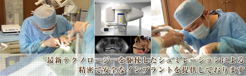 秋田県でインプラントをお探しの方！もりやま歯科医院へお越しください。